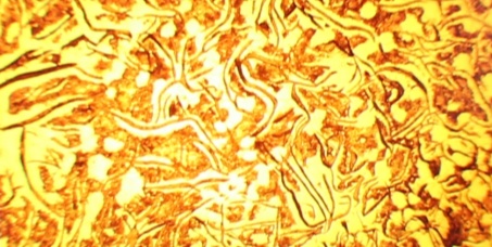 5 chiavi per prolungare la durata delle parti soggette a usura nella fusione a schiuma persa